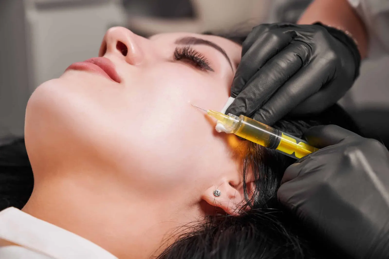 Sculptra treatment at NFuze Wellness