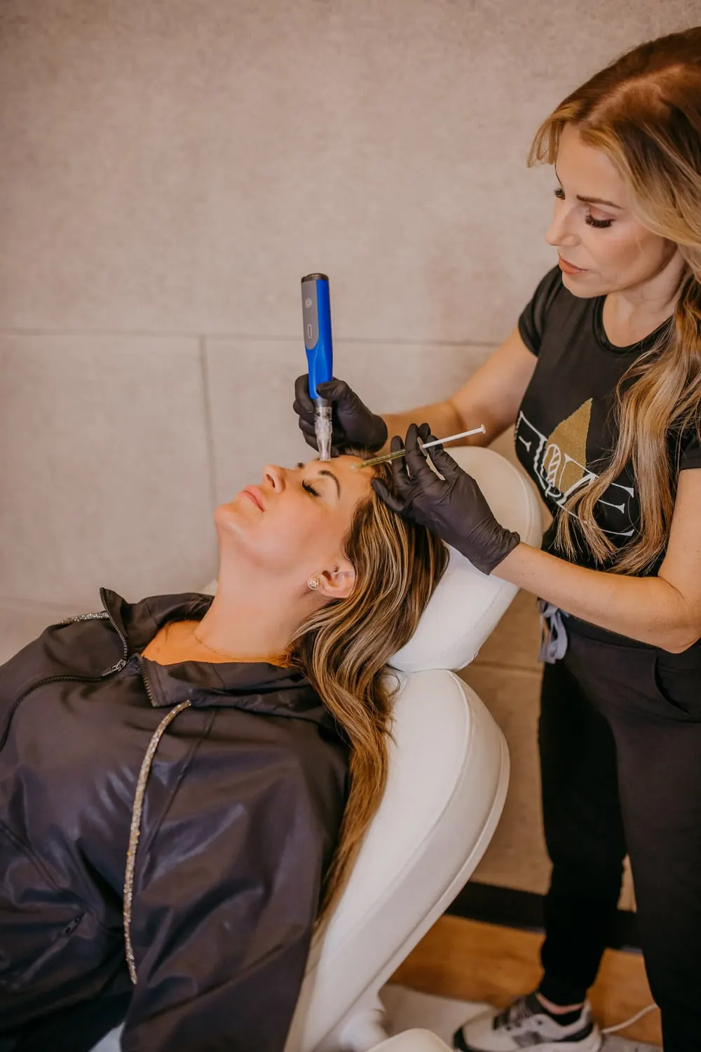 Scarlet RF Microneedling treatment at NFuze Wellness