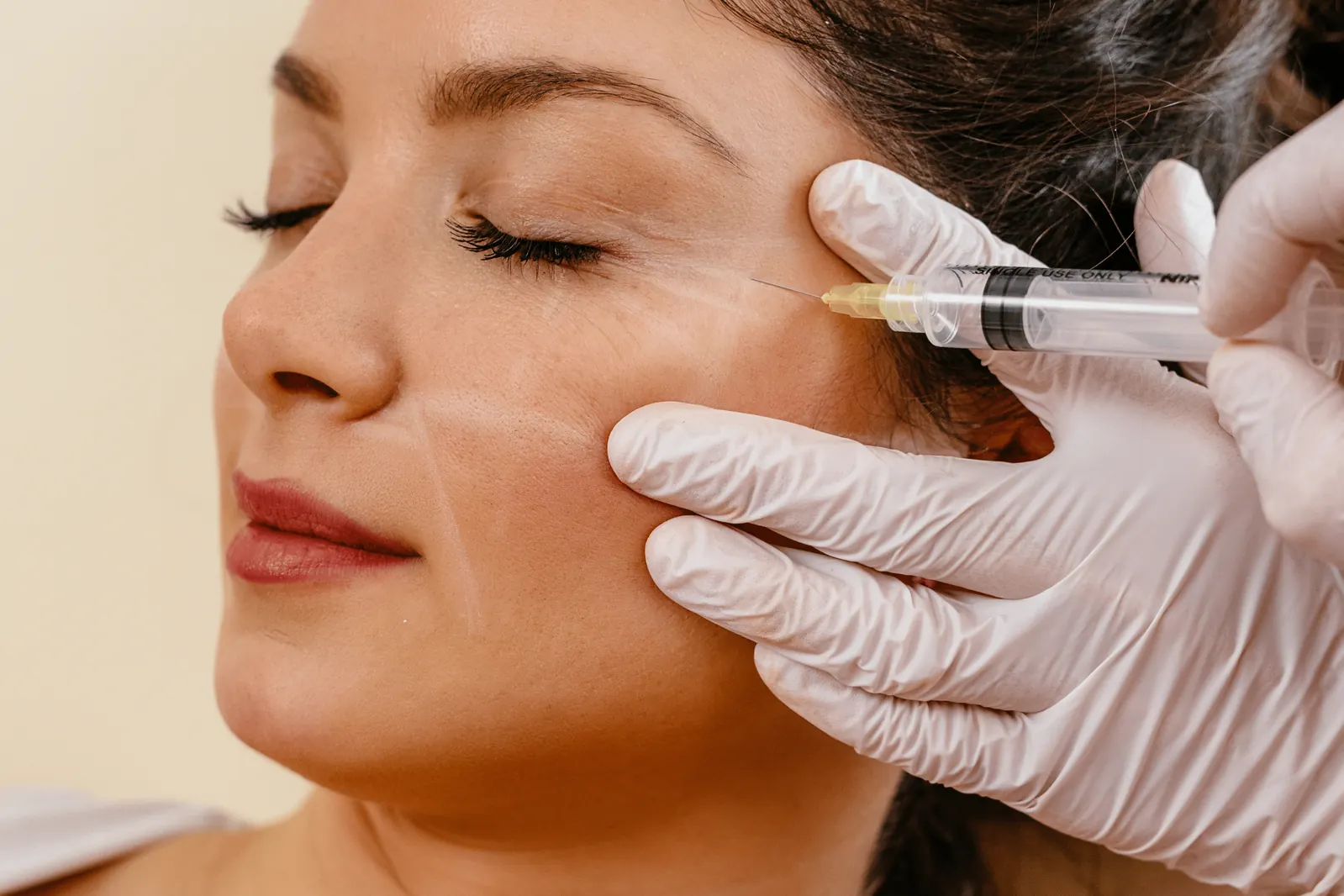 Microneedling treatment at NFuze Wellness