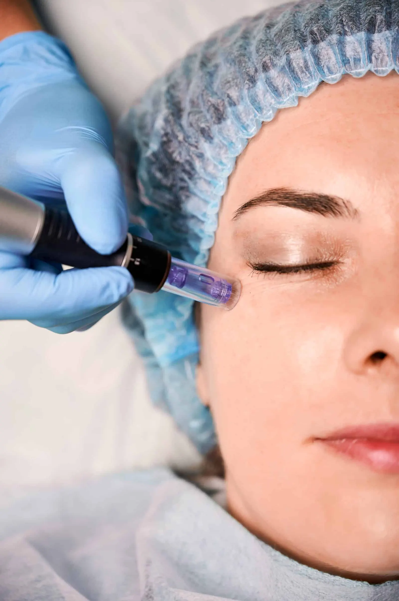 PRP Facial Treatments treatment at NFuze Wellness