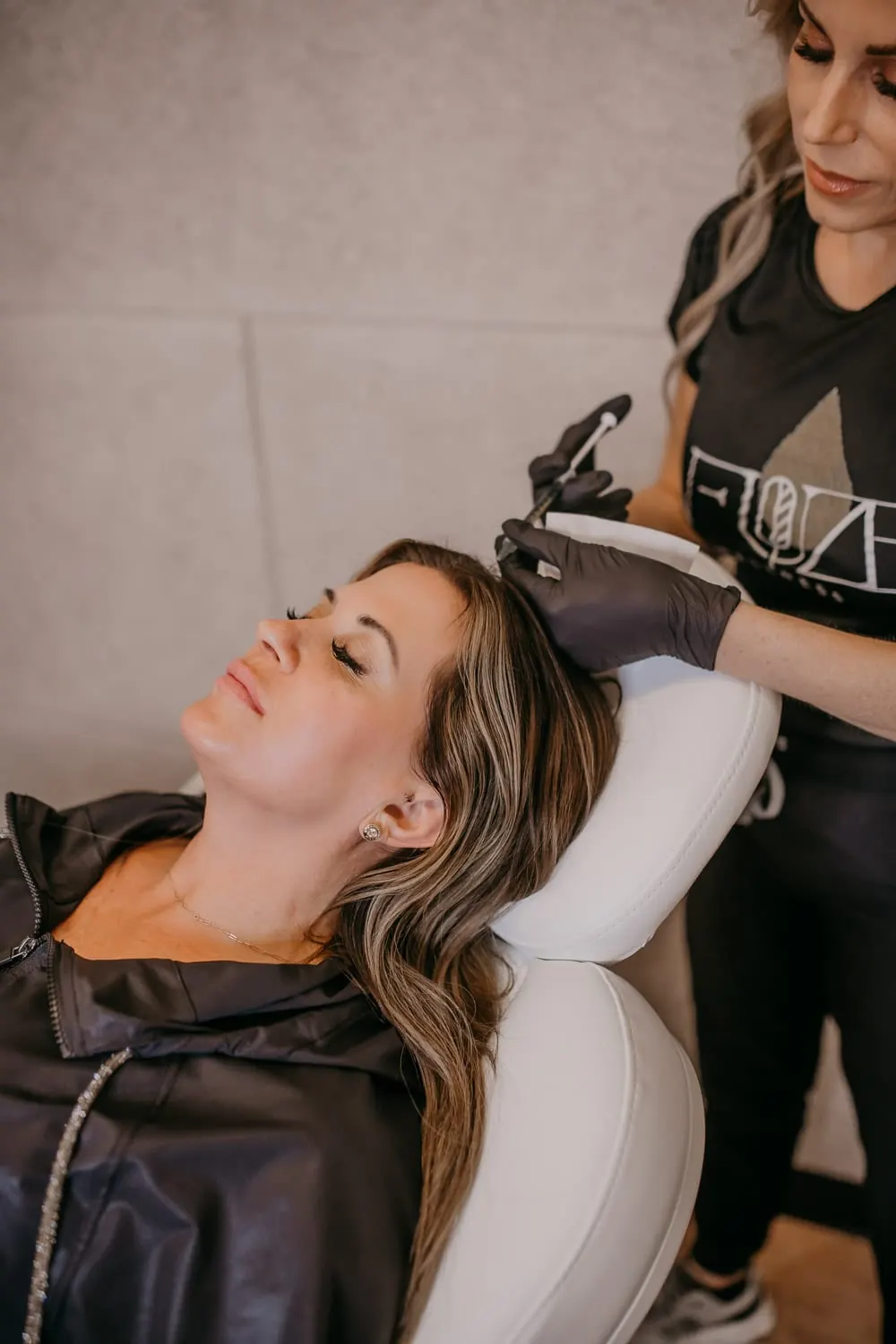 Scarlet RF Microneedling at NFuze Wellness